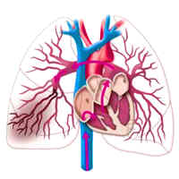 Subsegmental Pulmonary Embolism Increased Rate of Recurrent VTE