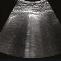 Technical Aspects and Clinical Applications in Lung Ultrasound