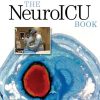 The NeuroICU Book