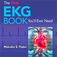 the-only-ekg-book-youll-ever-need