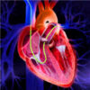 The Pulmonary Artery Catheter: A Solution Still Looking For a Problem