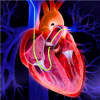the-pulmonary-artery-catheter-a-solution-still-looking-for-a-problem