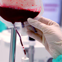 the-role-of-central-venous-oxygen-saturation-scvo2-as-an-indicator-of-blood-transfusion-in-the-critically-ill