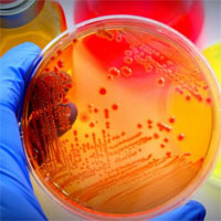 The role of POC Diagnostics in Combatting Antibiotic Resistance