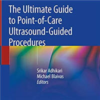 the-ultimate-guide-to-point-of-care-ultrasound-guided-procedures