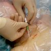 The use of continuous perineural catheters and other practices to optimize regional anesthesia in COVID-19 patients