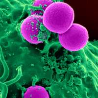 transmission-of-staphylococcus-aureus-between-health-care-workers-the-environment-and-patients-in-icu