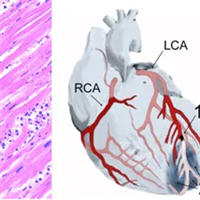 Troponin Elevation in Non-cardiac Critical Illness