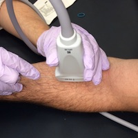 Ultrasound-Guided Peripheral Intravenous Access