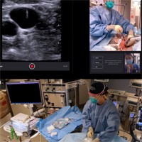 Ultrasound Teleguidance to Reduce Healthcare Worker Exposure to COVID-19