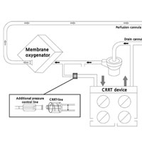 using-additional-pressure-control-lines-when-connecting-a-continuous-rrt-device-to-an-ecmo-circuit