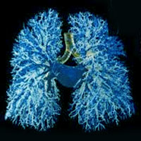 variation-of-poorly-ventilated-lung-units-measured-by-eit-to-dynamically-assess-recruitment