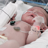 Wide variations found in evaluation of newborns for sepsis